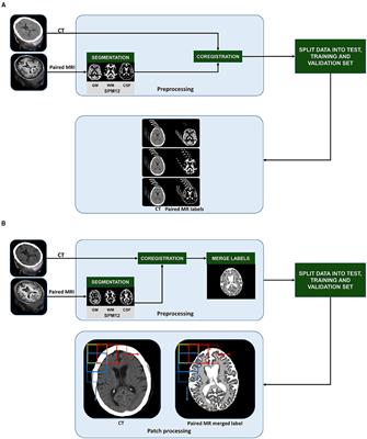 Comparison of Two-Dimensional- and Three-Dimensional-Based U-Net Architectures for Brain Tissue Classification in One-Dimensional Brain CT